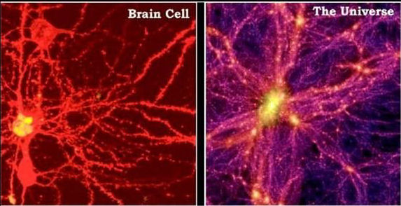Brain cell versus galaxy stars